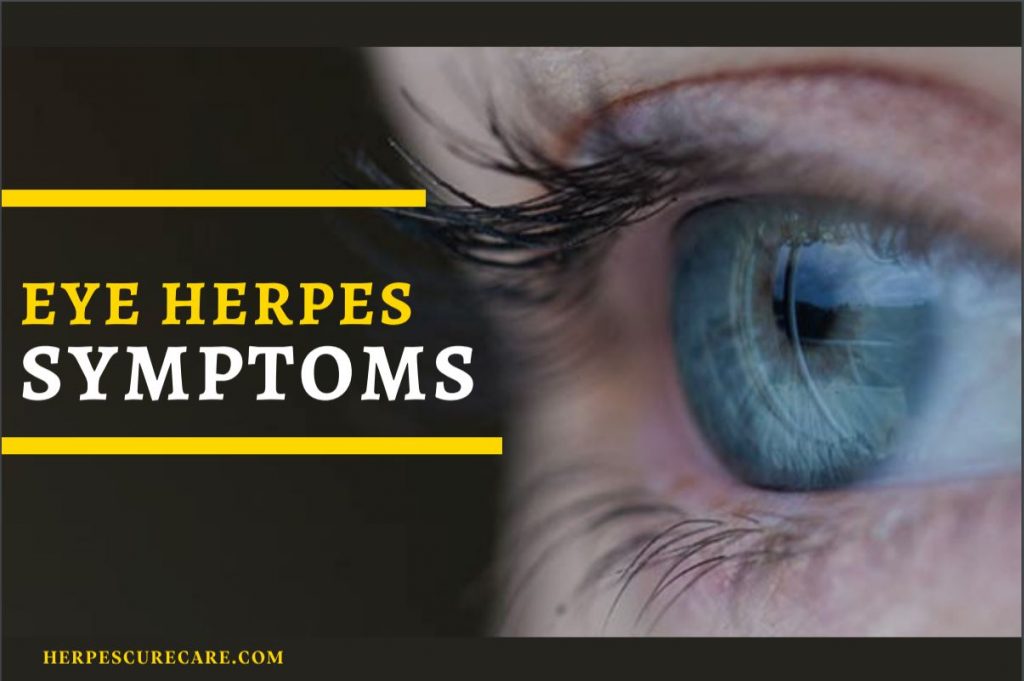 Insane But True Things About Eye Herpes YOU SHOULD KNOW 